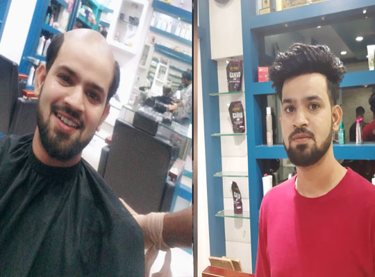 hair fixing in jaipur