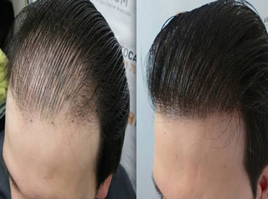 female wigs in jaipur